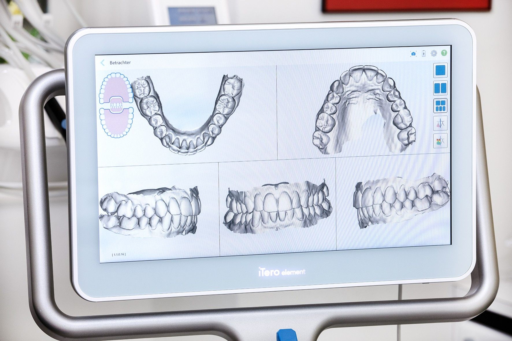 Erwachsenen-Kieferorthopädie